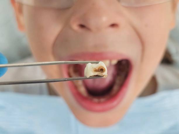 Best Same-Day Emergency Dentist in Tool, TX